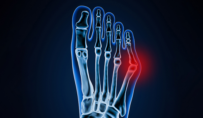 발/발목 이미지