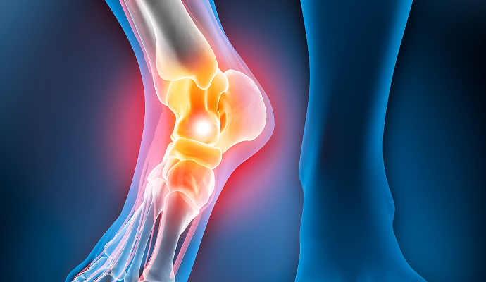 발/발목 이미지