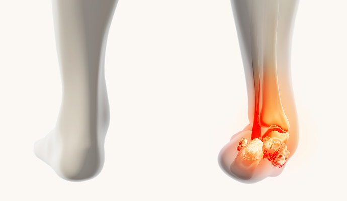 발/발목 이미지